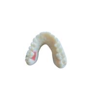 Quality Digital Oral Scanning PFM Dental Crowns Bridge Implantology Demands for sale