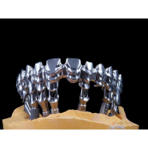 Quality FDA 3014652903 PFM bridge dental Highly Aesthetic Extremely Strong for sale