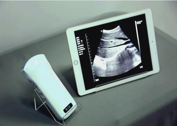China Windows Pocket Ultrasound Scanner Machines Electronic Phased Array factory