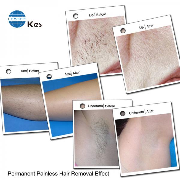 Quality 755nm / 808nm / 1064nm Painless Diode Laser Hair Removal Double TEC 3 Wavelength for sale