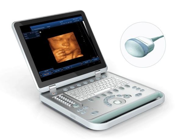 Quality Medical Ultrasound Machine Portable Ultrasound Scanner 4d Ultrasound Equipment for sale