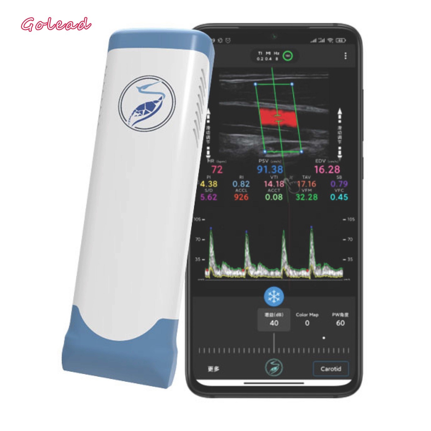 China Electronic Linear Array Wifi Wireless Portable Ultrasound Scanner 12MHz factory