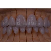 China FDA/ISO/CE Certified Digital Crown Teeth Artificial Crown Any Size factory