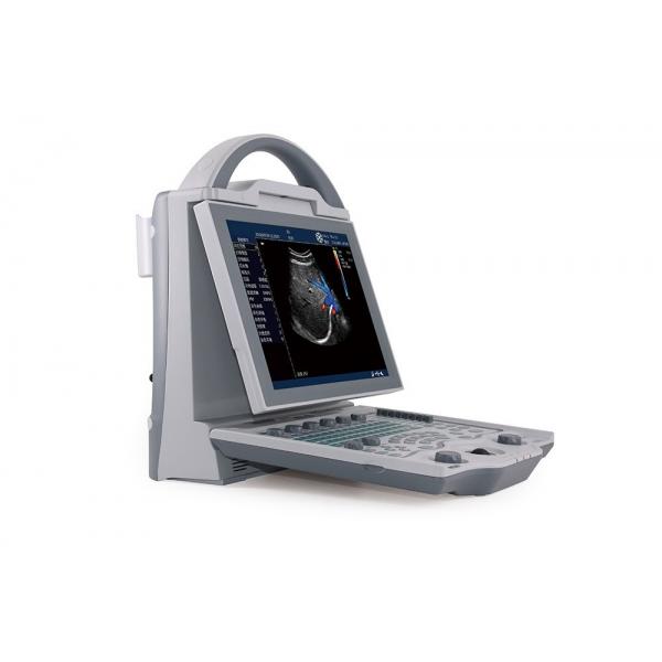 Quality 16GB Entry Level 2D Laptop Color Doppler Ultrasound System For Pregnancy for sale