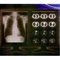 Quality Bright Clear Digital X Ray Film , Konida Medical Laser Transparency Film for sale