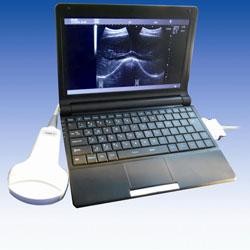 Quality Mobile Ultrasound Machine Digital Laptop Ultrasound Scanner with 100 Frames for sale