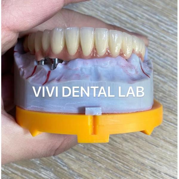 Quality Alloy Dental Implant Supported Crowns Implants And Bridges Digital for sale