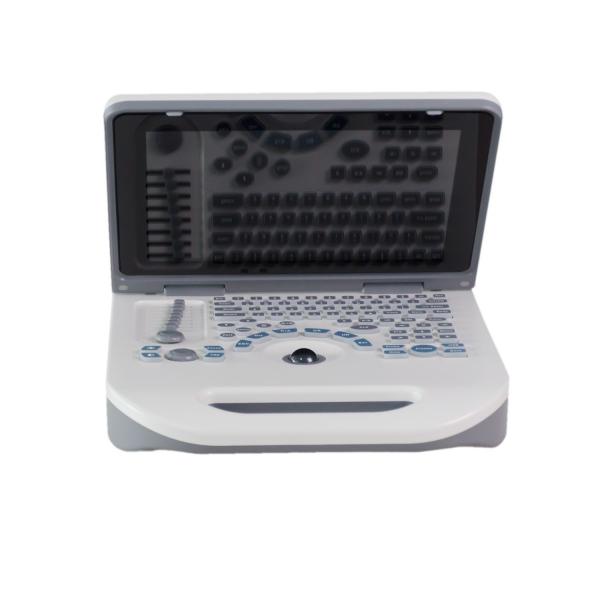 Quality Xianfeng Laptop USG Scan Machine Ultrasound Device Li-Ion 6.5MHz R13 for sale