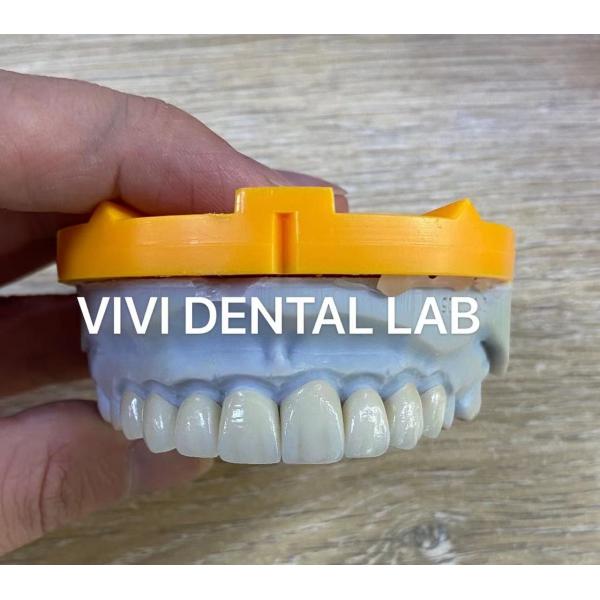 Quality Ivoclar Emax Laminate Veneers Translucent Professional High Level China Dental Lab for sale