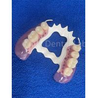 China Stain Resistant Removable Dental Partials Stable Replace Missing Teeth Prosthesis factory