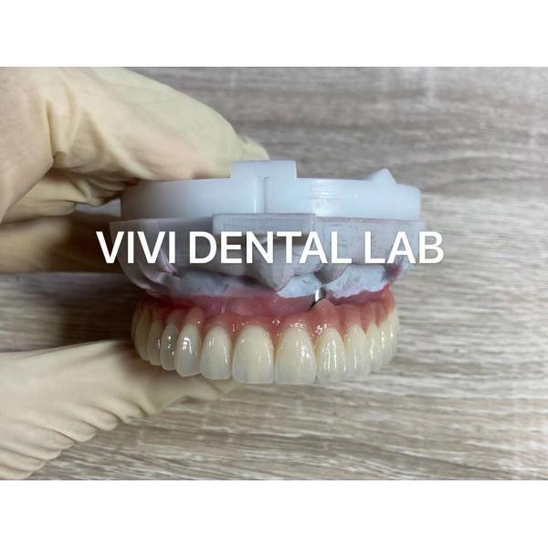 Quality Screw Implant Digital Dental Crowns And Bridge Scheftner Ivoclar Translucency for sale