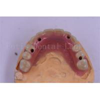 China Dental Implant Titanium Tooth Crown Precision Fit Custom Design factory