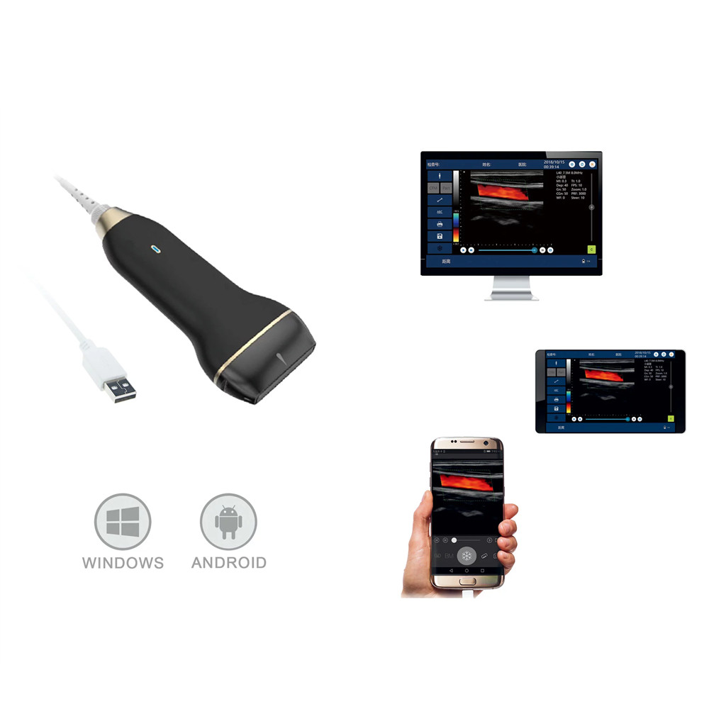 China Compact Digital Portable Mobile Ultrasound Scanner Supported Andriod And Window factory