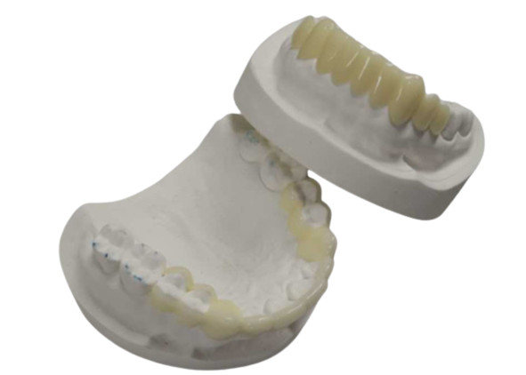 Quality High Durability CAD CAM 3D Printing Temporary Crowns Durable Resin for sale