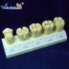 China Standard Rubber Teeth Mould Dental Teaching Model , Study Models In Dentistry factory