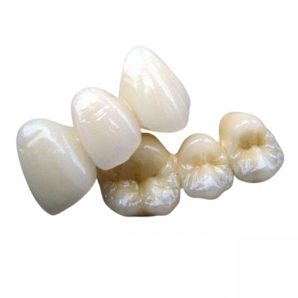 Quality PFM Co Cr 3014652903 Ceramic Dental Bridge Custom Colour Stability for sale