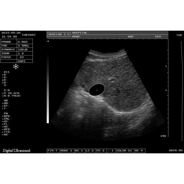Quality Medical Home Pregnancy Ultrasound Machine DRF RDA Imaging USB Port for sale