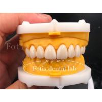 China Fast And Efficient Digital Dental Crowns Size Customization Tooth Implant Crown factory