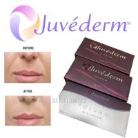 China Juvederm Ultra 3 Lidocaine Hyaluronic Acid Lip Filler Injection factory
