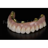 China Full Arch Restoration All On Six Implants Minimally Invasive Solution factory
