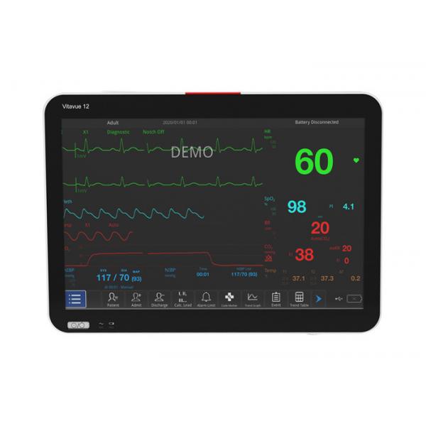 Quality Touch Screen 40-240bpm Ecg Spo2 And Nibp Monitor 12.5mm/S To 50mm/S Print Speed for sale