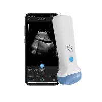 China HDMI Video Output 3.6MHz Diagnostic Ultrasound Doppler Scanner For POCUS factory