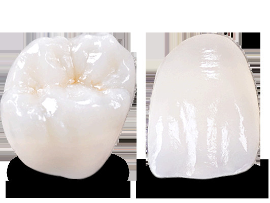 Quality Dental IPS EMax Crown Professional Lithium Disilicate Crown China Dental Lab for sale