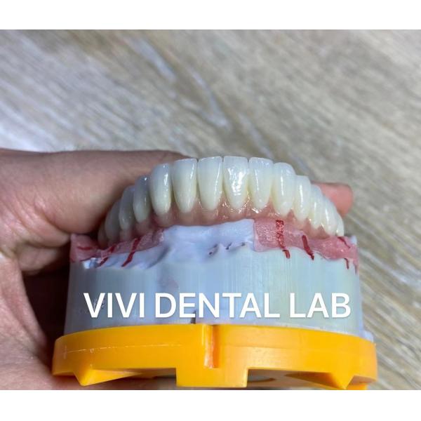Quality Digital Cement Dental Bridge Implant Translucency FDA Certified for sale