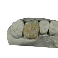 Quality CE ISO Flexible Porcelain Dental Crown For Back Teeth Restoration for sale