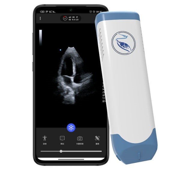 Quality Depth 18.9cm Handheld Ultrasound Scanner For Iphone 3.6MHz for sale