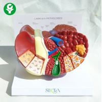 china Hepatic Liver Pathological Liver Anatomy 3d Model Easy Preserve Durable