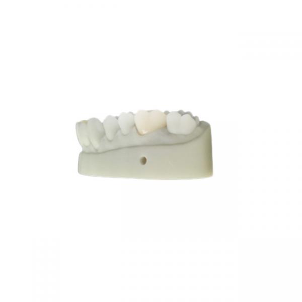 Quality OEM 3D Printed Dental Models CAD CAM Design For Denture Laboratory for sale