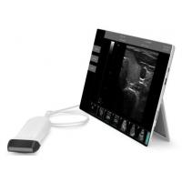 Quality Ultrasound Scan Equipment Portable Ultrasound Scanner Ipad Ultrasound Machine with Probes of 2~15MHz for sale