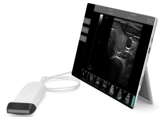 Quality Ultrasound Scan Equipment Portable Ultrasound Scanner Ipad Ultrasound Machine for sale