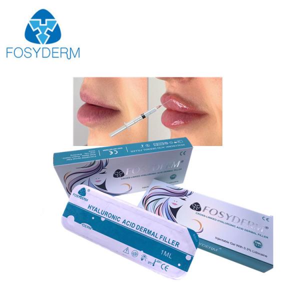 Quality Lip Cheek And Nasolabial Dermal Filler Hyaluronic acid Ha Injections 1ml 2ml 5ml for sale