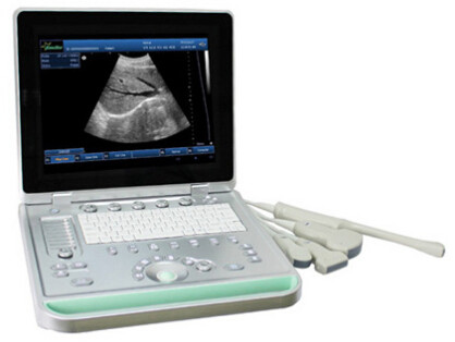 China 3D Digital Laptop Portable Ultrasound Scanner With All Kinds of Probe factory