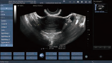 Transvaginal Ultrasound Probe Wireless Ultrasound Probe Color Portable Ultrasonic Diagnostic Devices