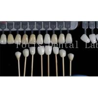 China Customization Natural Dental Veneers Fake Teeth Overlays High Strength factory