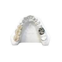 Quality Ultra Hard Digital Porcelain Dental Crown Health Safety High Density for sale