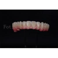 China Full Arch Implant Bridge All On 4 All On 6 For Complete Dental Restoration factory