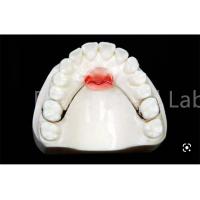 China Adjustable Mouth Expanding Retainer For Safe Teeth Retention And Expansion factory