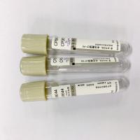 China Accurate Ratio Glucose Blood Tube Grey Cap Sodium Fluoride EDTA 1:9 factory