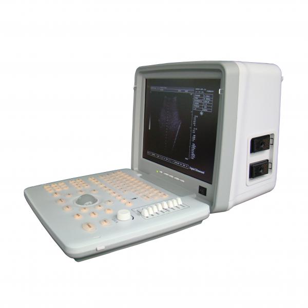Quality Full Digital OB GYN USG Scan Machine 0 To 120dB 12in Led Display for sale