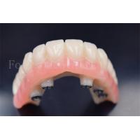 China Customized Dental Implants Crowns Replacement Wear Resistance factory