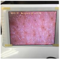 China White Wifi Skin Moisture Checker Skin Moisture Sensor With Photo Displaying In Ipad factory