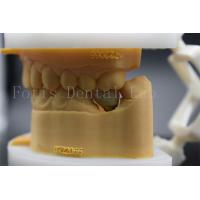 China Long Lasting Polished Dental Lab Crowns Precision Fit Comfort For Patients factory