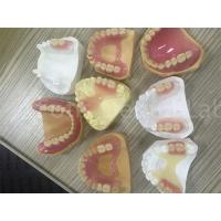 China Flexible TCS Valplast Removable Partial Denture Easy To Adjust factory