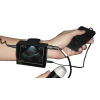 China Wrist Veterinary ultrasound scanner wrist veterinary ultrasound machine for sale