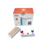 China Vannamei shrimp White Spot Syndrome Virus WSSV Rapid Test Kit Prawn Baculovirus PCR Kit factory
