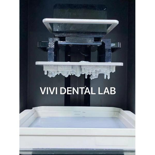Quality Digital 3D Printing Dental Crowns Tooth Professional Accurate for sale